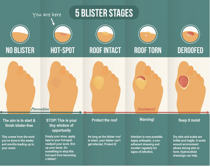 blister stages